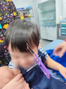 Врачи спасли ребёнка: двухлетний малыш получил проникающую травму головы, упав на ножницы